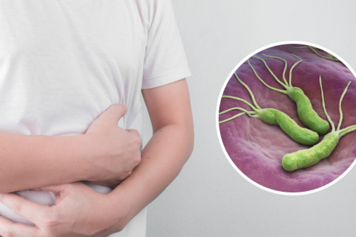 🌟 Хотите узнать свой статус по Helicobacter pylori и пройти экспертную гастроскопию у японского профессора? Тогда Вы можете обратиться к нам! 🌟