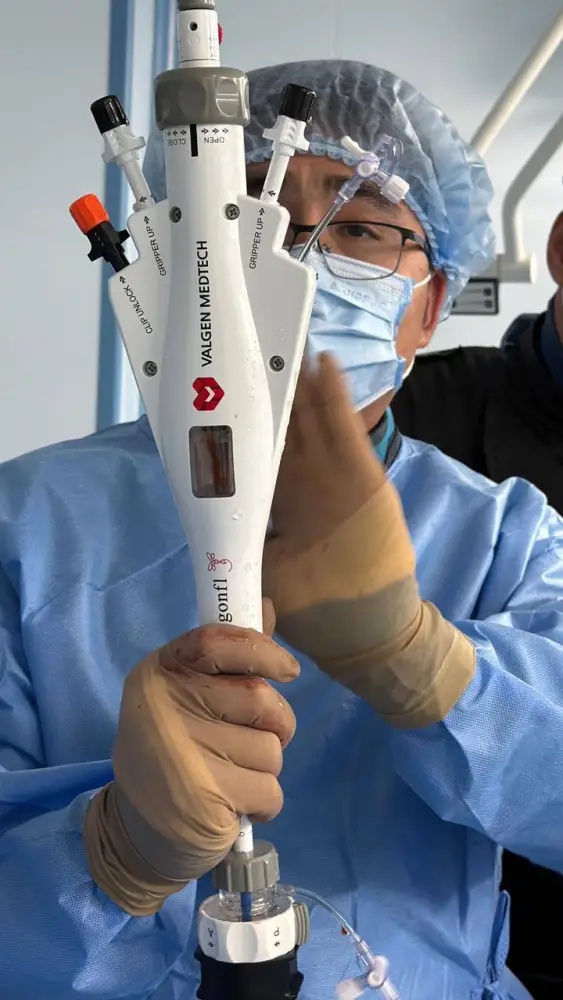 Восстановление функций митрального клапана у пациента с сердечными проблемами